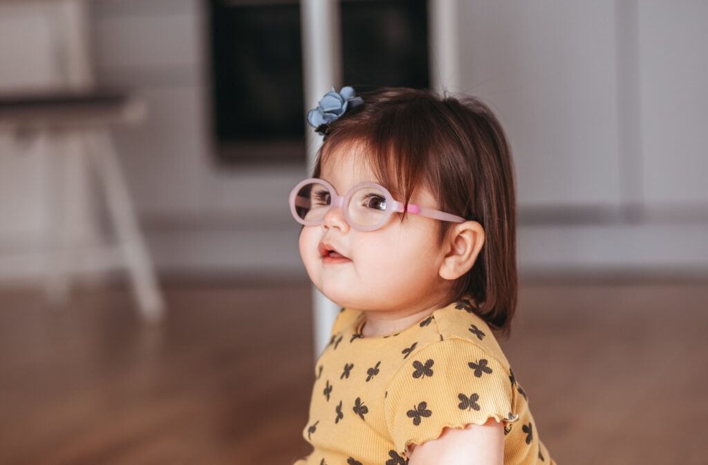 A baby wearing eyeglasses due to astigmatism.